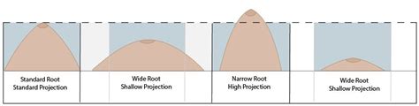 boobs|Breasts: Anatomy, Types, and Conditions